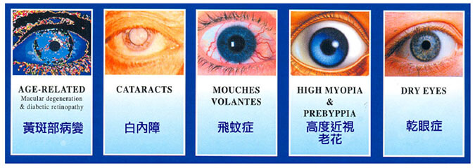 退化性黃斑病變(AMD) 視網膜剝離與飛蚊症 白內障 乾眼症 青光眼 預防高度近視引起的眼睛病變
